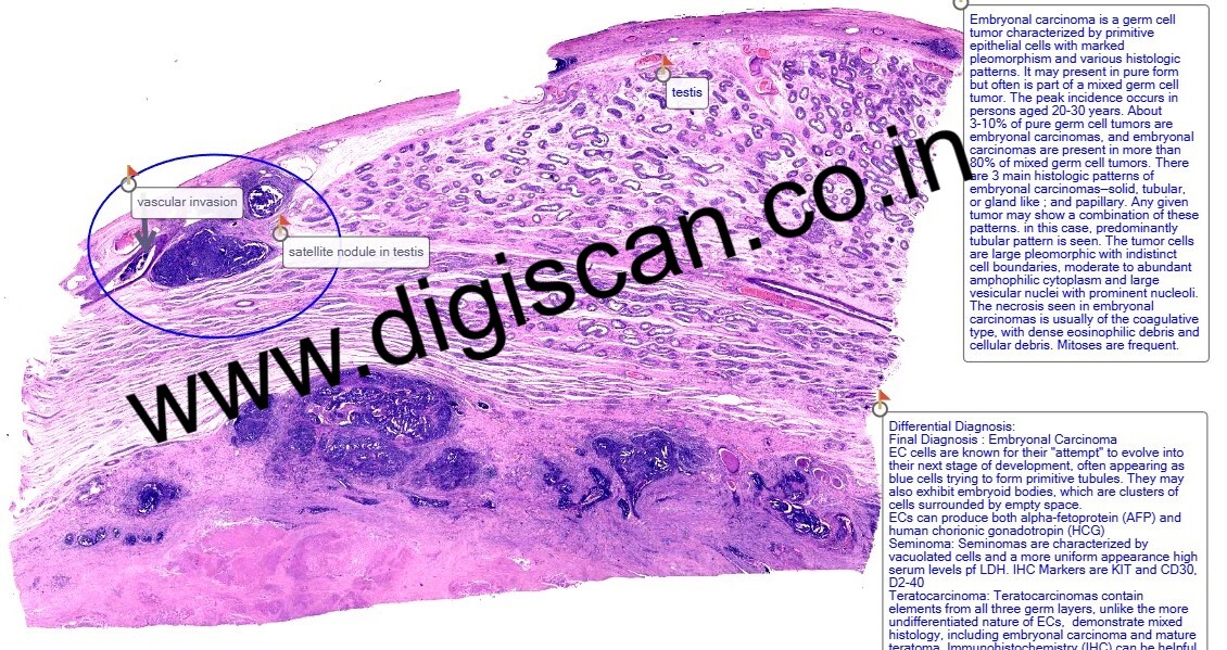MD Pathology Exam Cases (Digital Slides & Spot Diagnosis Cases)